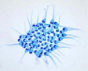 Myxozoa