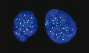 Haploid cell on the left (with 23 chromosomes); Diploid cell on the right (with 46 chromosomes) (with 46 chromosomes) (PRNewsfoto/Yissum)