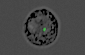 A monocyte converted into a decoy by the malaria parasite: The green dot is the genetic material “cargo” inside the nanovesicle produced by the parasite