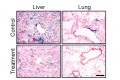 Drug treatment eliminates senescent cells from tissues of old mice. The blue staining shows senescent cells in lung and liver tissue. The amount of the staining is significantly reduced following the drug treatment