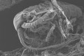 Vue au microscope d'une bactérie sur un fragment de déchet plastique, prélevé en Méditerranée. / © Expéditions Med / Erik Zettler