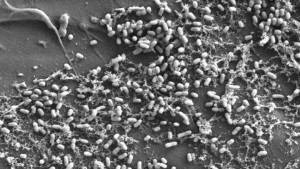 Vue au microscope électronique de bactéries du genre Vibrio dans une expérience de laboratoire / © Erik Zettler / Marine Biological Laboratory / Expéditions Med