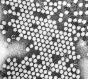 entérovirus responsable de la poliomyélite © F. Murphy, S. Whitfield, CDC, DP